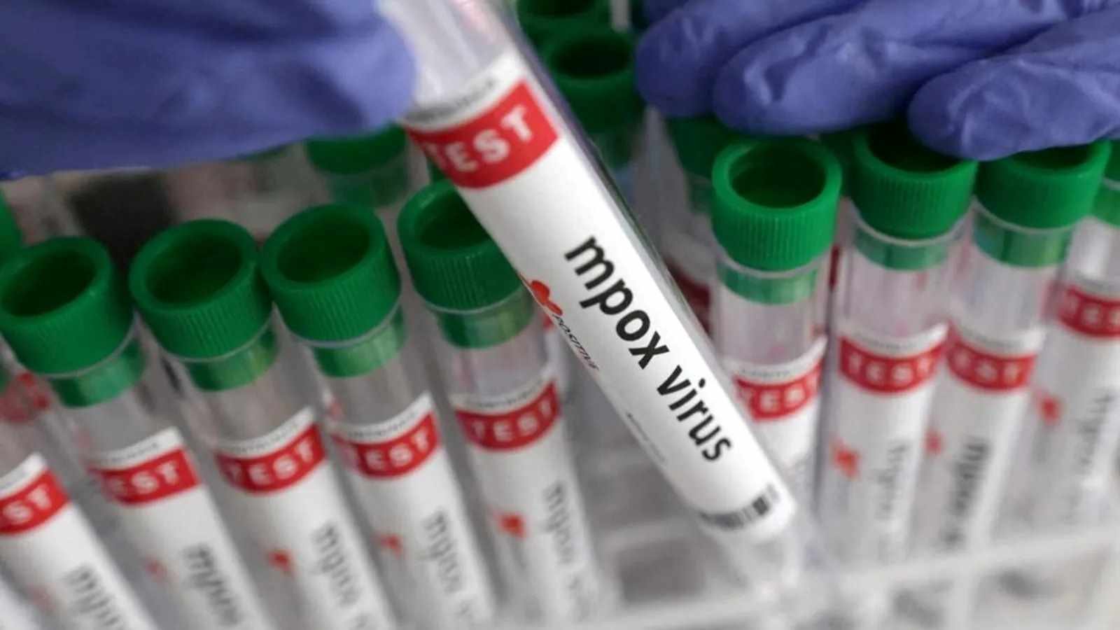 क्या भारत में फैल रहा MPOX ?