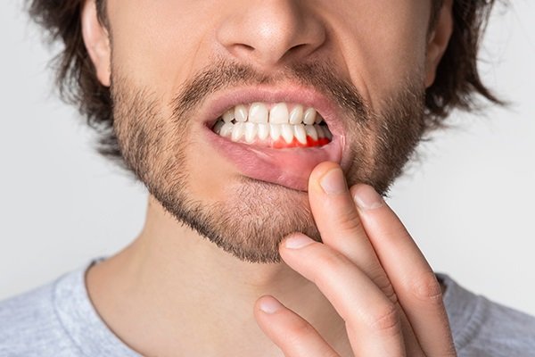 मसूड़ों से खून आना – एक आम परेशानी या गंभीर खतरे की घंटी?